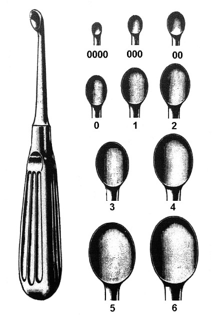 Kostěná lžíce typu Volkmann 00 4 mm