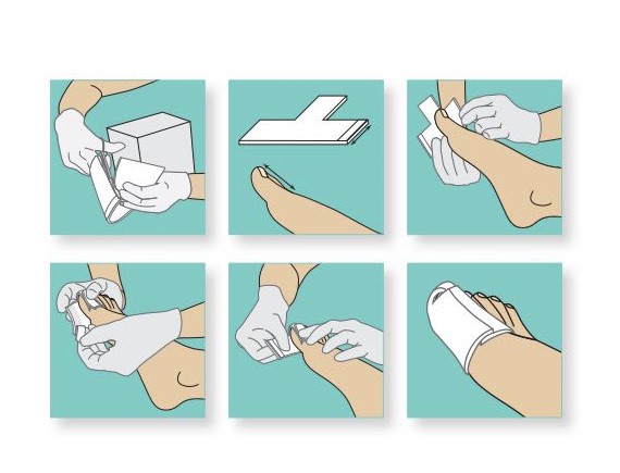 Ligasano bílý sterilní obvaz 14 x 10 x 0,5 cm 1ks T-obvaz na prsty