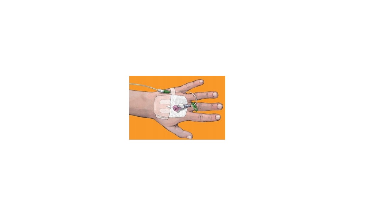 IV3000 1-HAND 10* 12cm 1ks fixační obvaz na vpichy - Obrázek 2